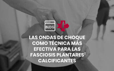 Las ondas de choque como técnica más efectiva para las fasciosis plantares calcificantes (espolón calcáneo)