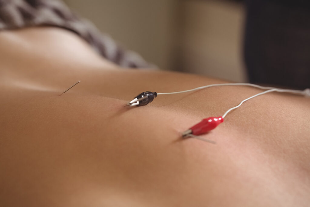 fisioterapia avanzada