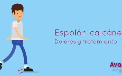 ¿Qué es el espolón calcáneo?